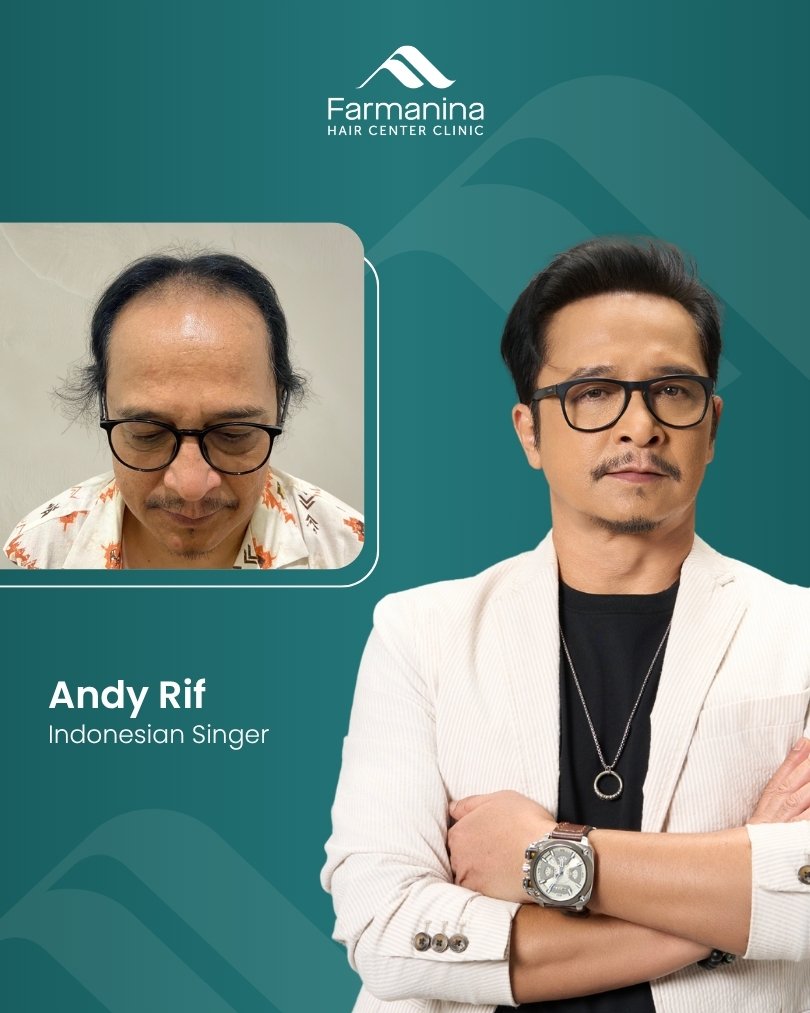 Andy RIF